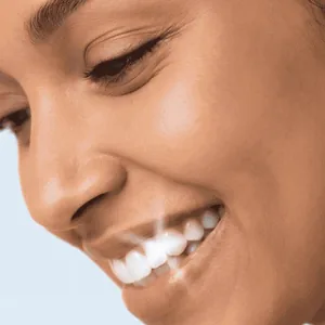 Close-up of a smile after using the Auraglow Teeth Whitening Kit